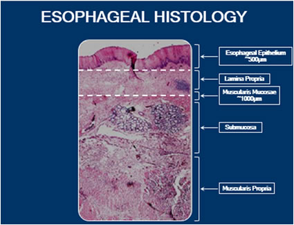 esophageal histology